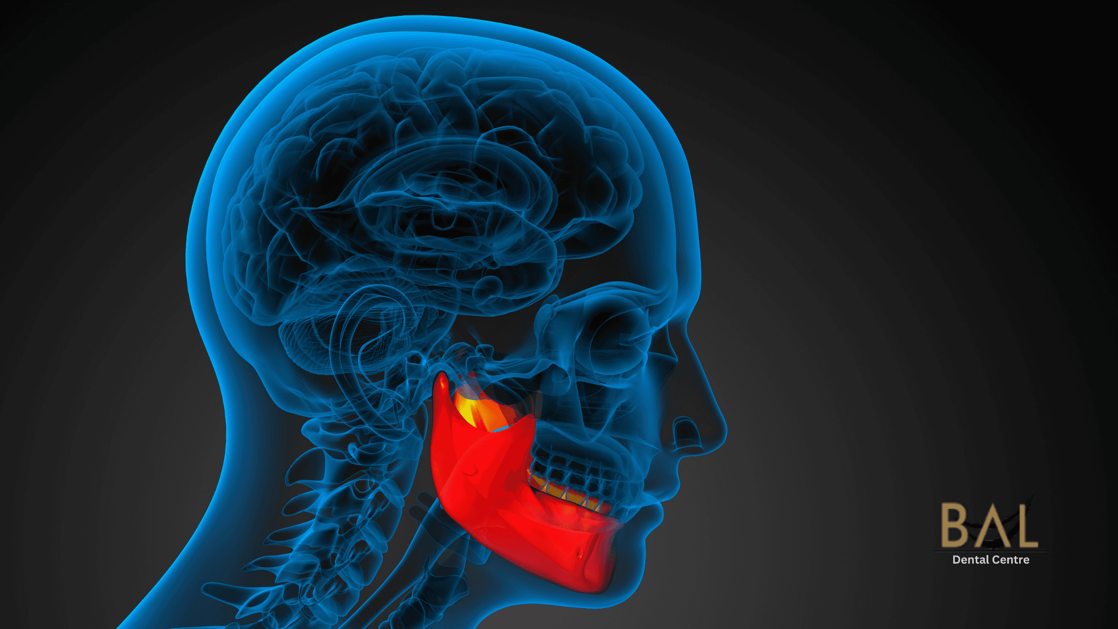 Do You Need a Bone Graft Before Dental Implants