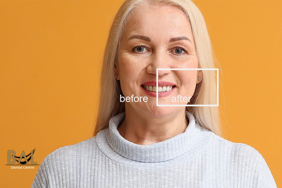 Smile Makeovers – What Are They and Are They Worth It?