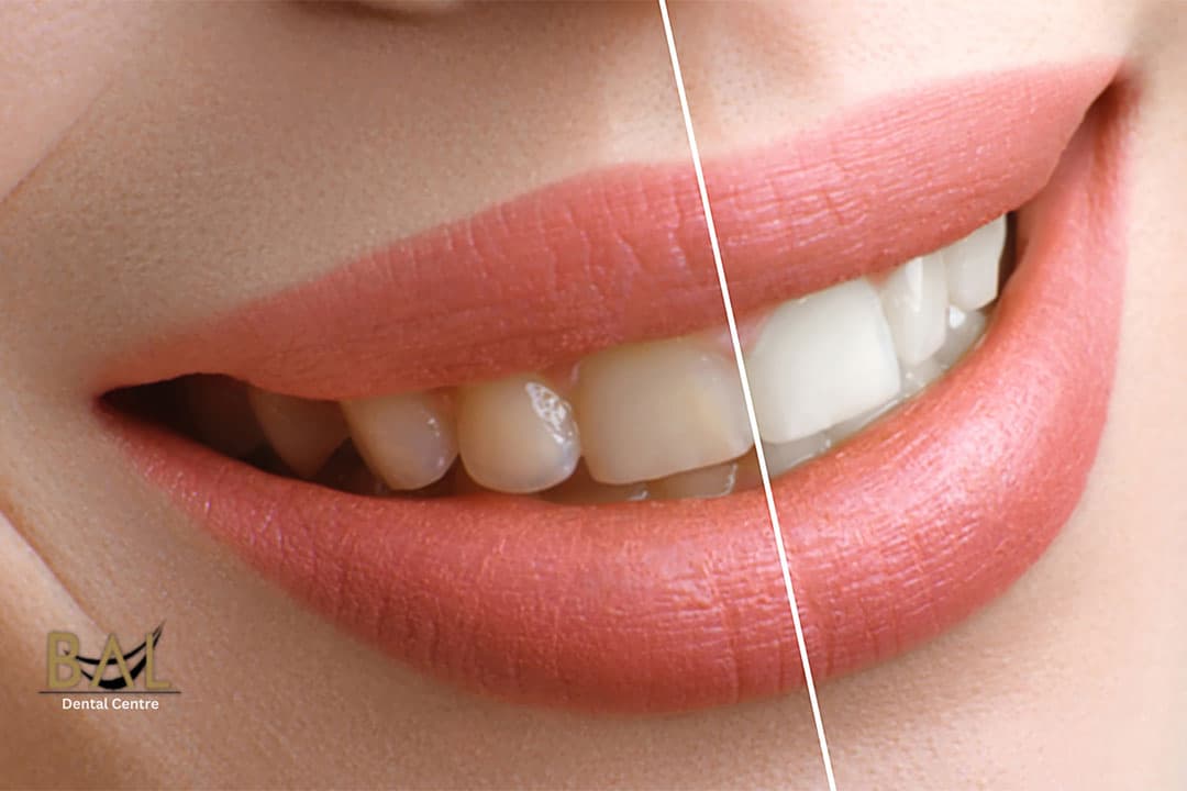 Before and After: Real-Life Cosmetic Dentistry Transformations